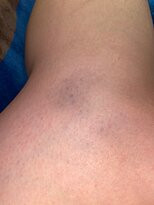 Alpine Slide at Magic Mountain-大熊湖必去景点