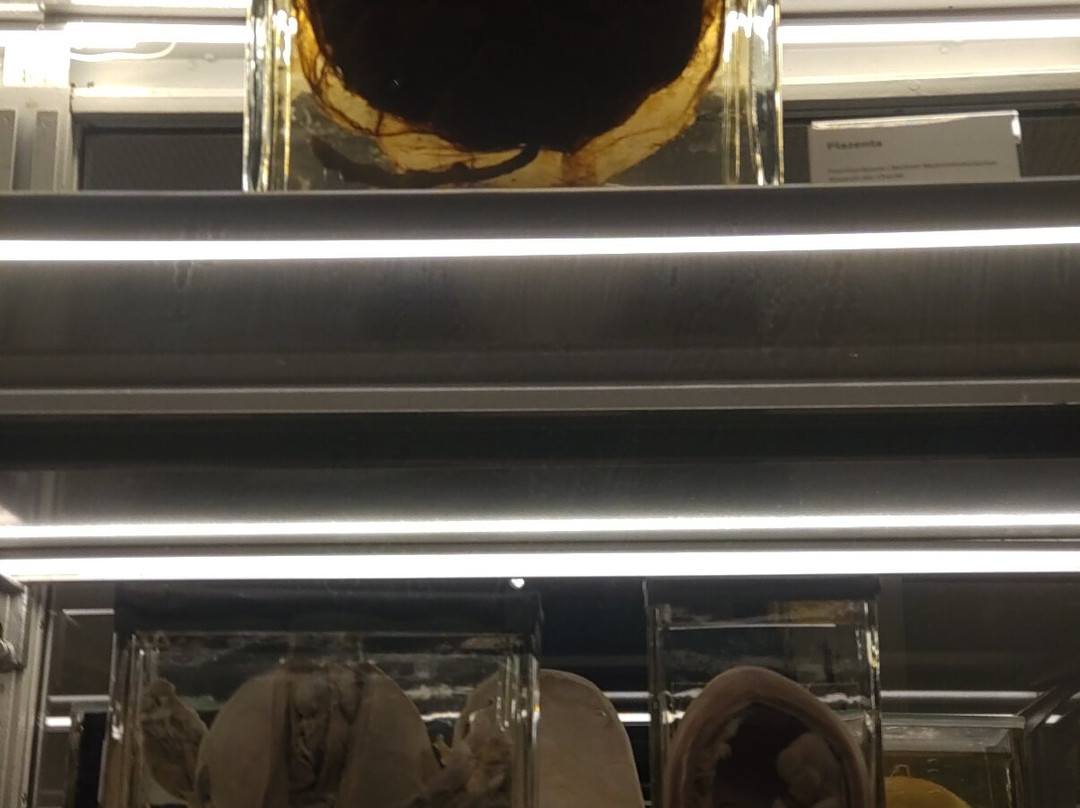 Deutsches Medizinhistorisches Museum-因戈尔施塔特必去景点