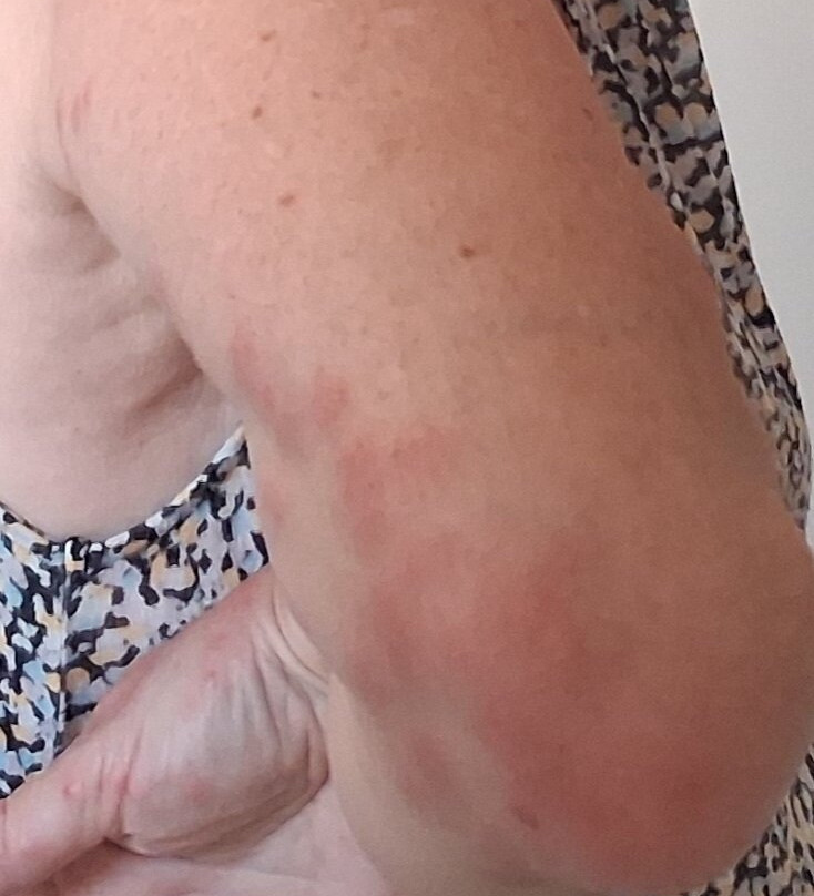 彭赫斯特酒店主图