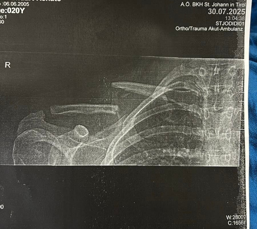 Mountaincart-圣约翰堤候必去景点