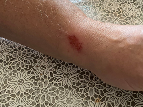 Claudius Therme-科隆必去景点