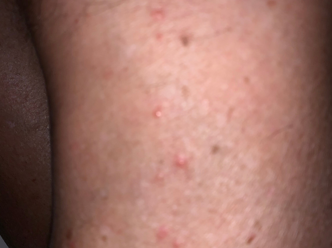 韦纳奇旅程住宿酒店主图