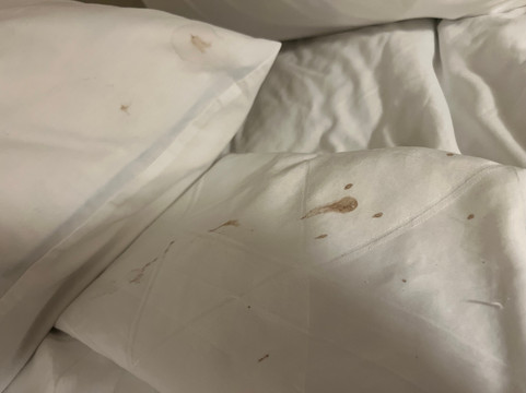 兰卡斯特假日酒店主图