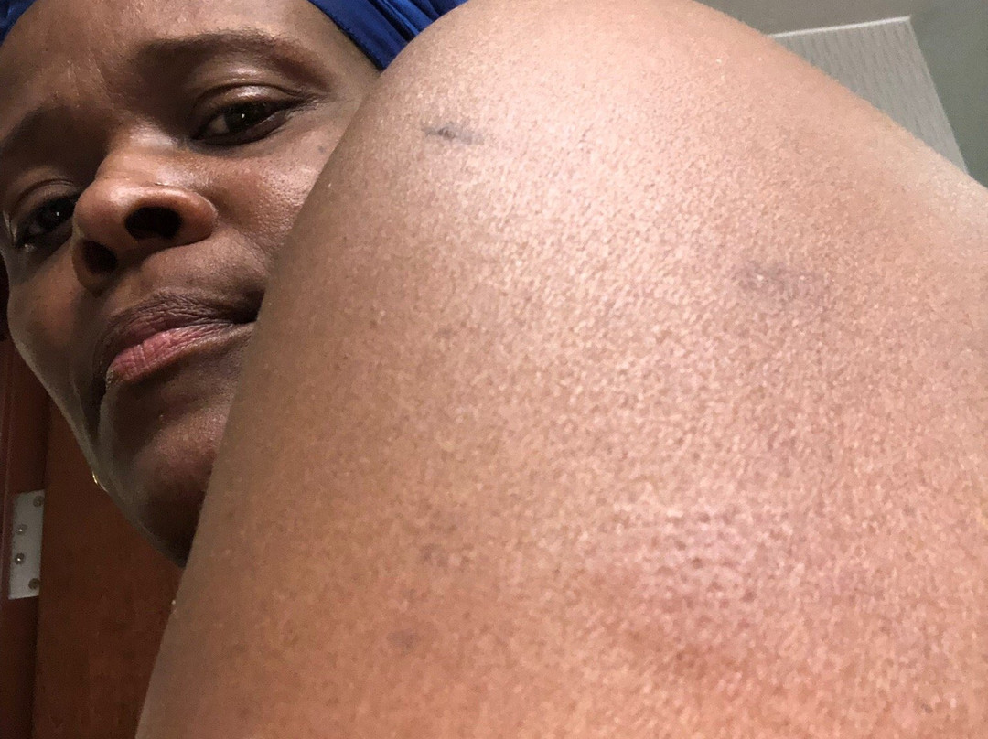 Drury Inn & Suites St. Louis O'Fallon, IL主图