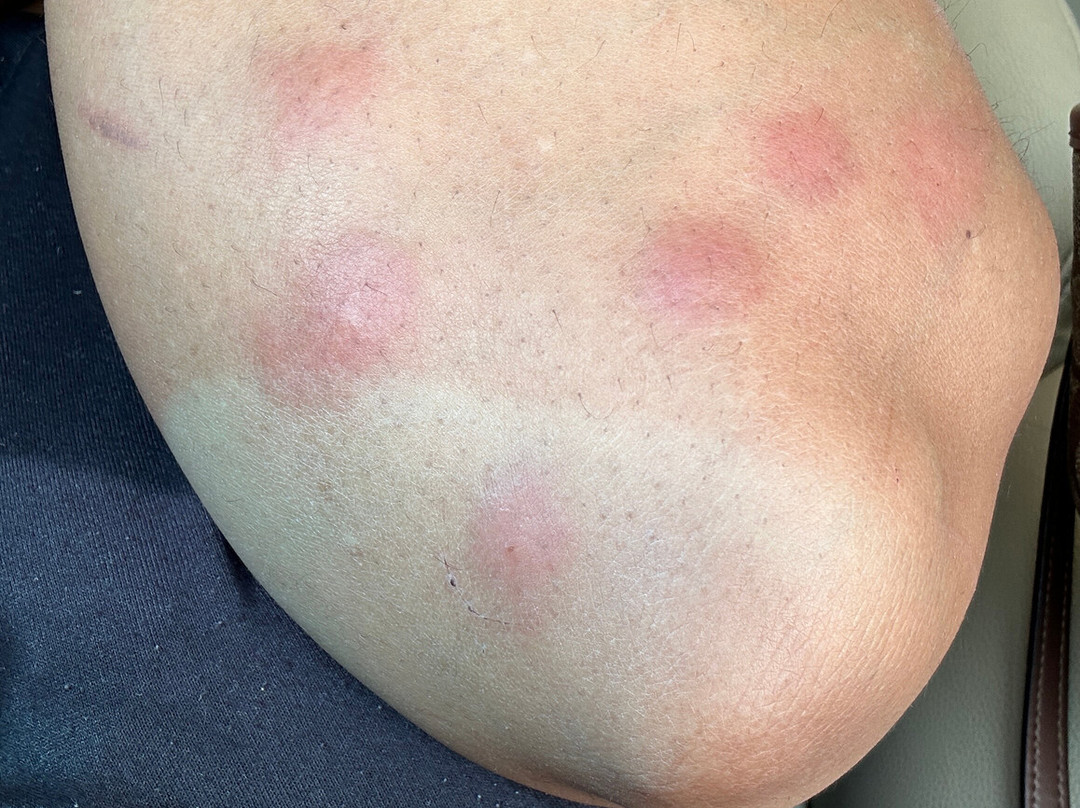 哥伦比亚东北/杰克森堡拉昆塔温德姆酒店主图