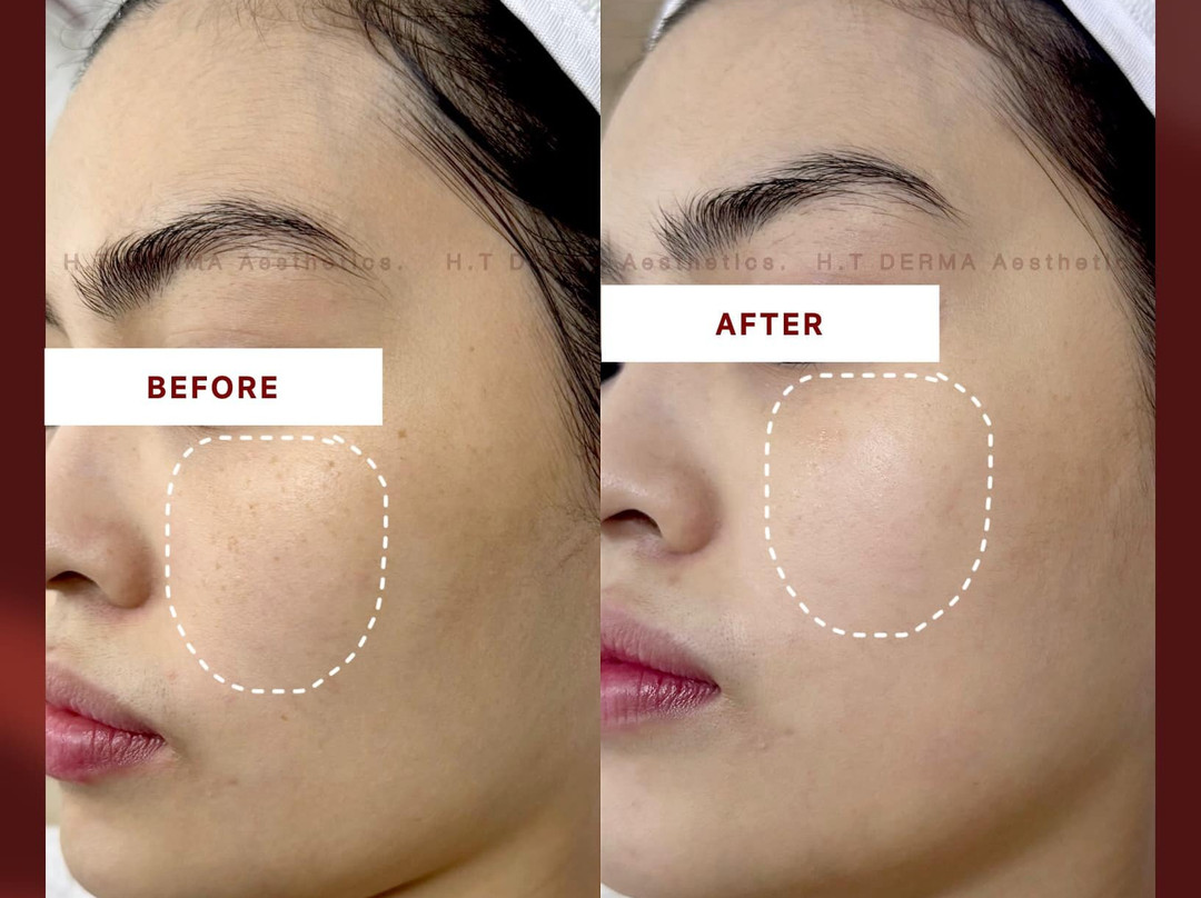 Ht Derma Aesthetics Spa-Hai Ba Trung必去景点