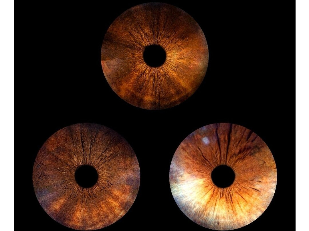 Eyemazy - Lyon-里昂必去景点