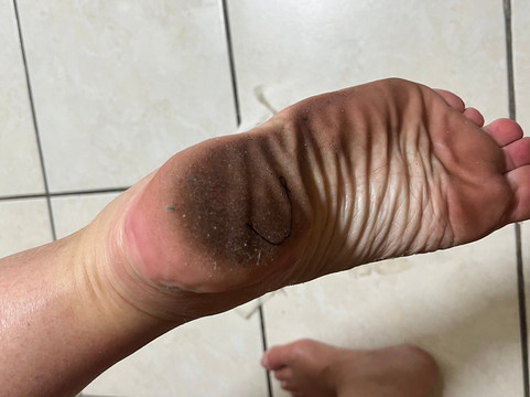 马可海滩度假套房酒店主图