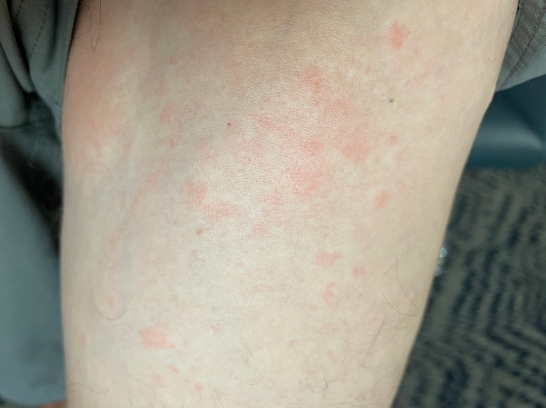 尚佩恩乌班纳大学区烛木套房酒店主图