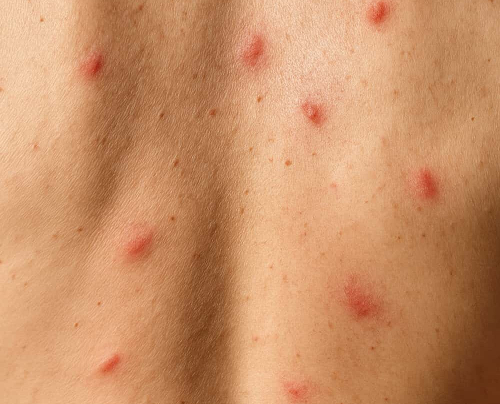 Hilton Garden Inn Annapolis Downtown主图