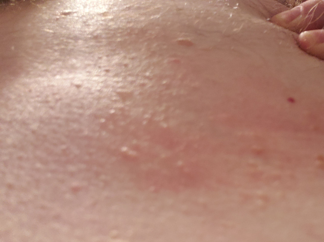 戴维斯拉金塔旅馆&套房酒店主图