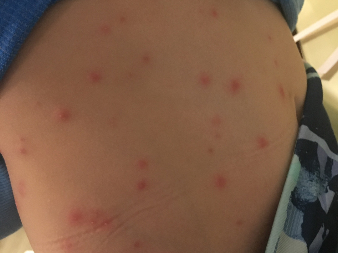 托伦斯豪生酒店主图