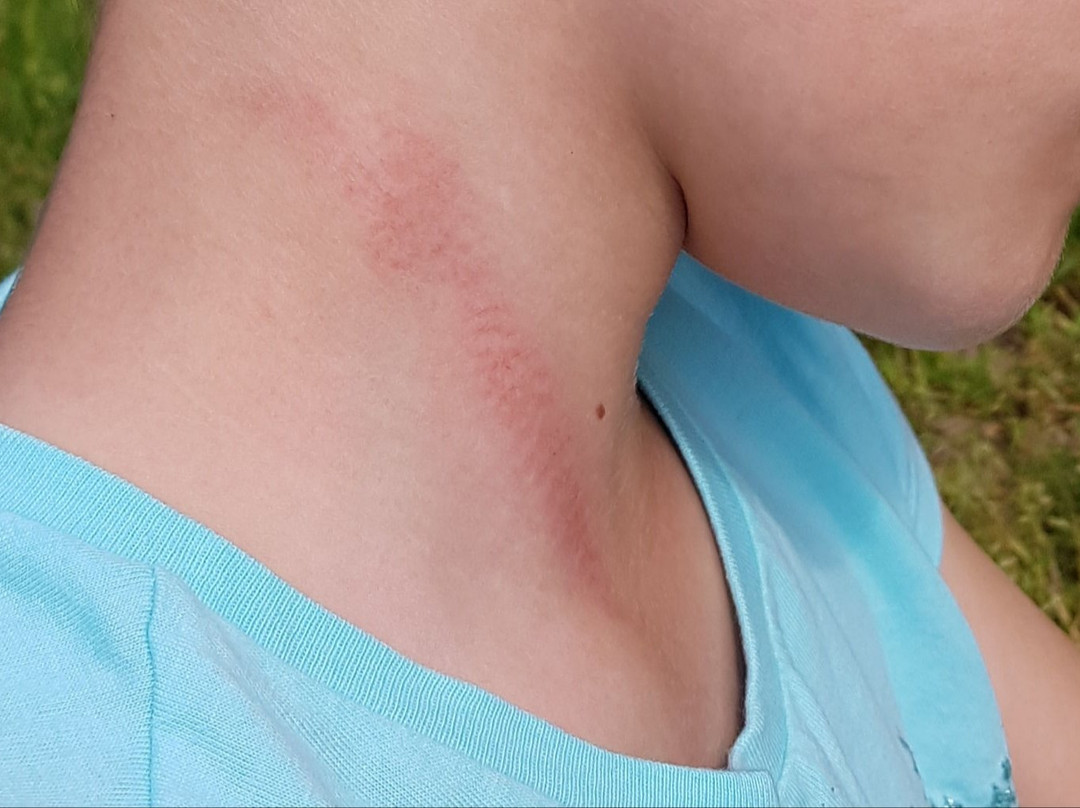 Parc Arbre Aventure-Kruth必去景点