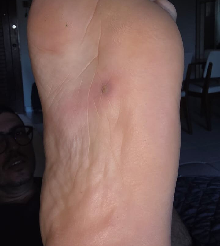 Lagoa de Carcara-Nisia Floresta必去景点