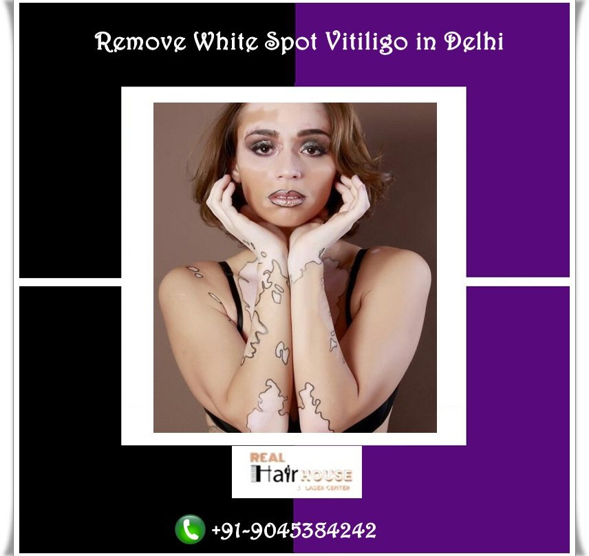 Bennett's Patch and White's Paddock-布里斯托尔必去景点