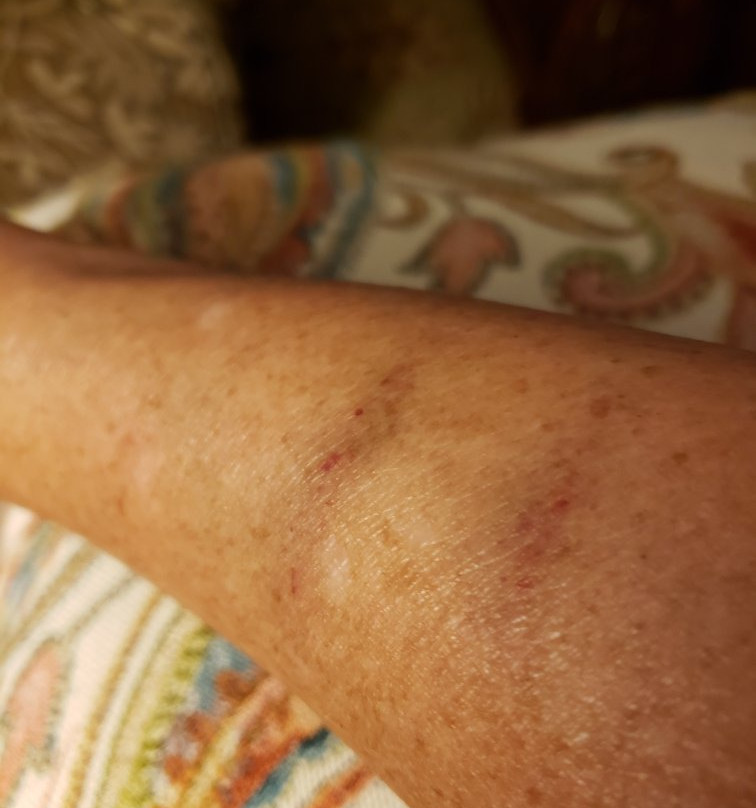 Lake Arrowhead Chalets主图