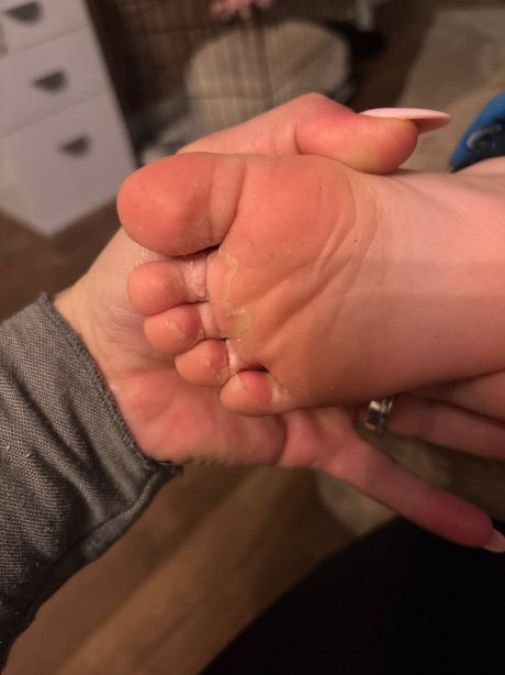 Landal de Lommerbergen-官方