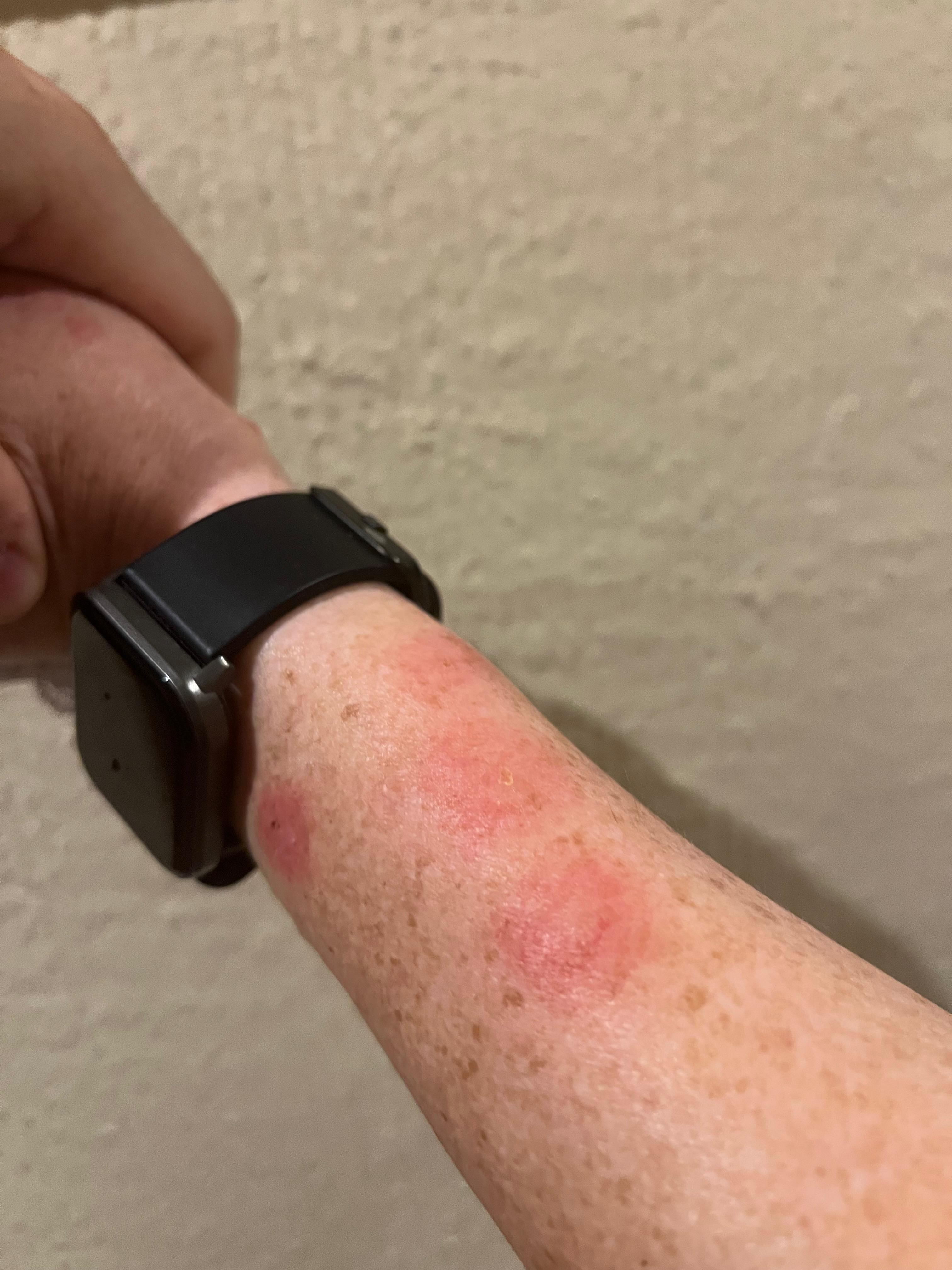 Hotel Termes La Garriga-官方