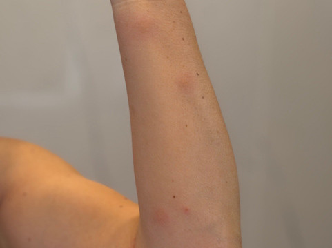 阿尔卑弗勒里酒店及公寓主图