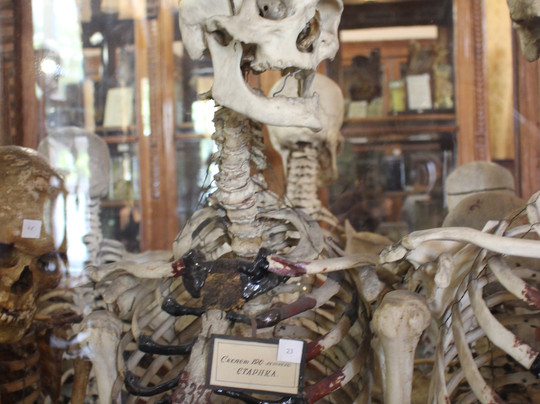 Museum of Human Anatomy-敖德萨必去景点