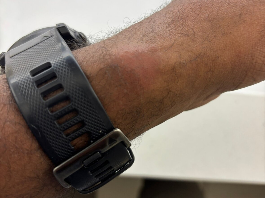 智选假日套房酒店阿比林主图