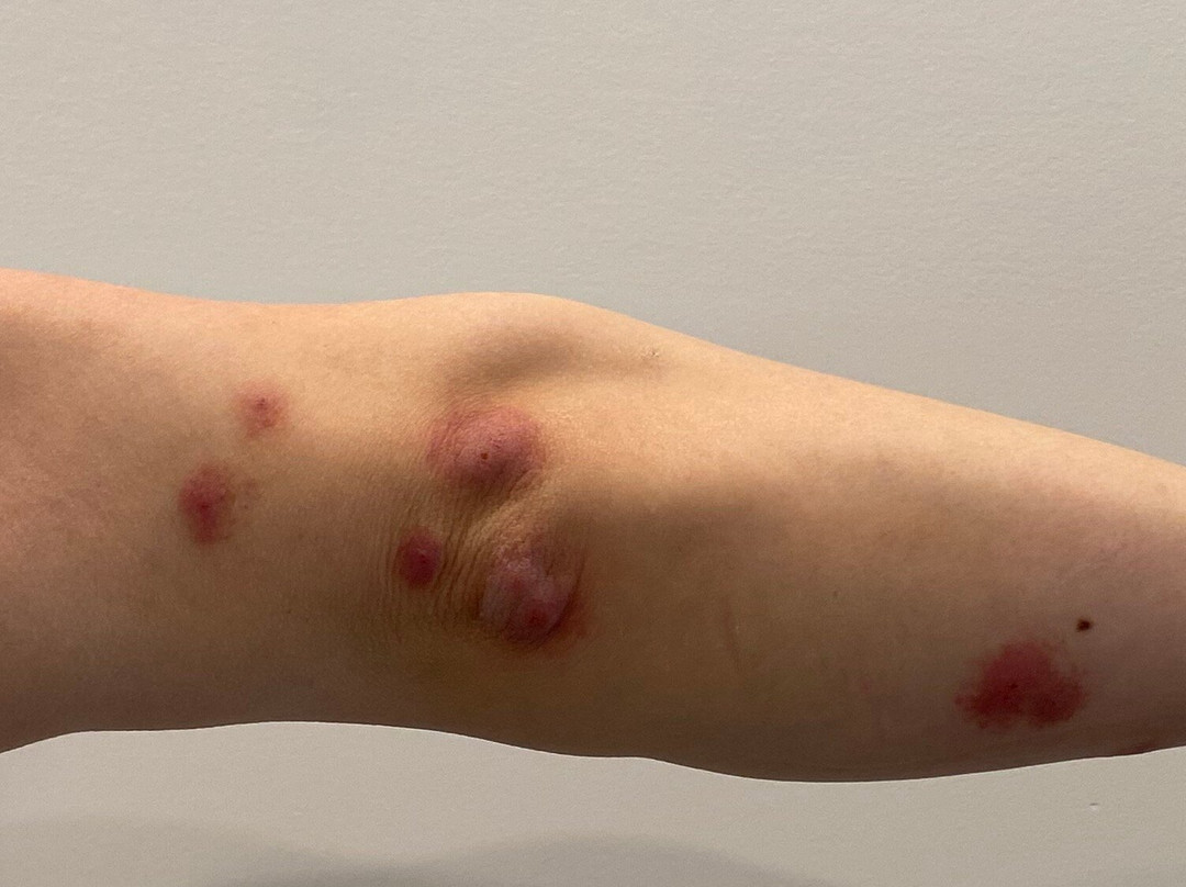 哈利森凯悦嘉轩酒店主图