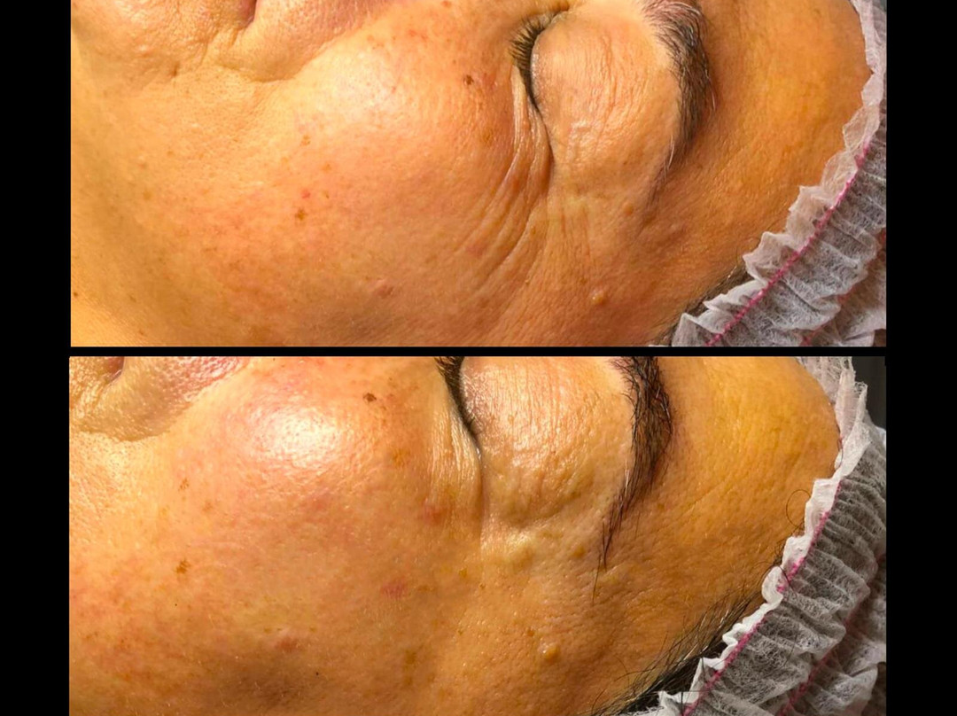 Mirko Wellness & Spa-布斯托-阿西齐奥必去景点