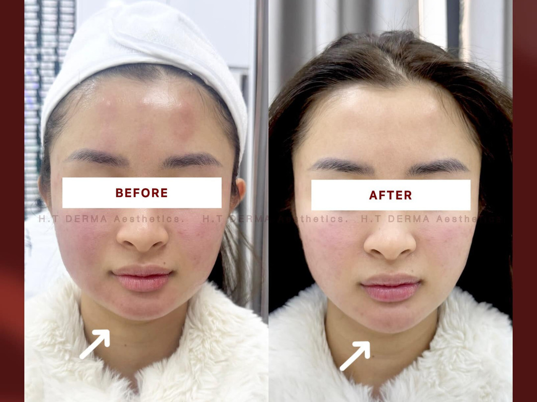 Ht Derma Aesthetics Spa-Hai Ba Trung必去景点
