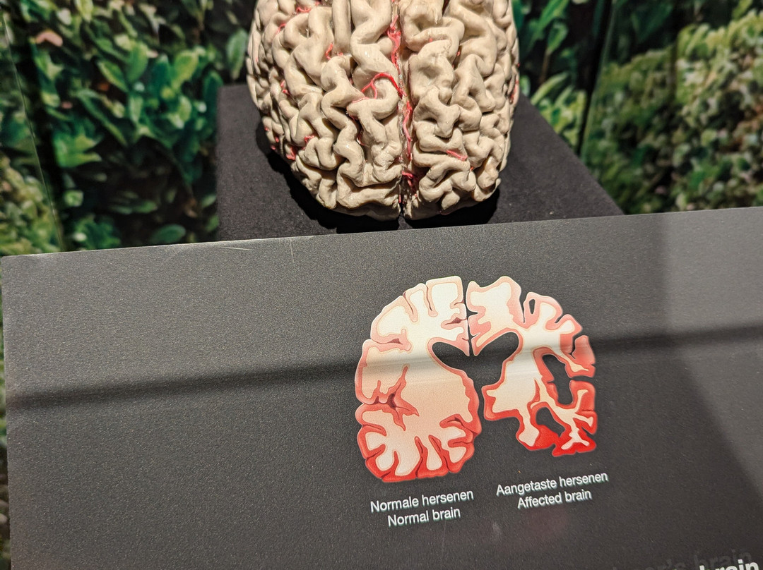 人体世界展览-阿姆斯特丹必去景点