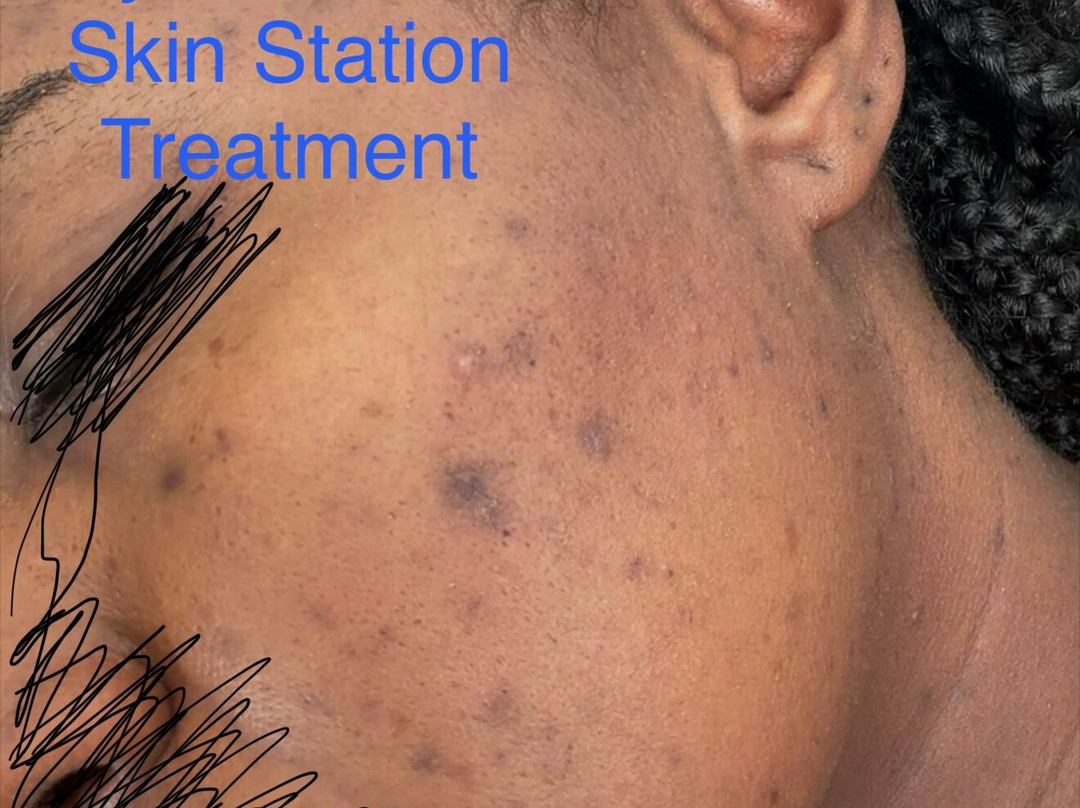 Skin Station-Yonkers必去景点