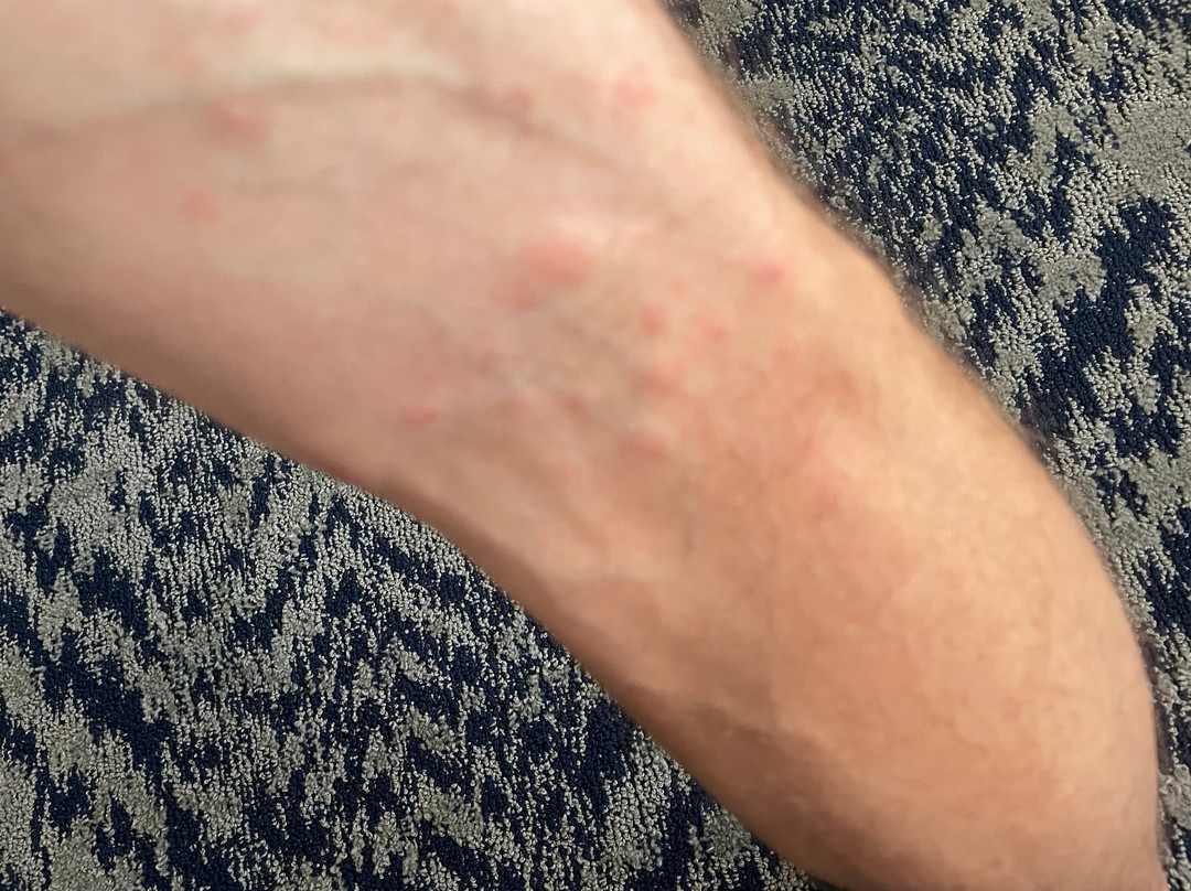 尚佩恩乌班纳大学区烛木套房酒店主图