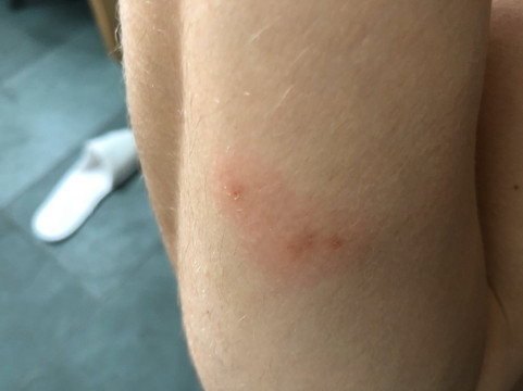 Kronenhotel Seefeld主图