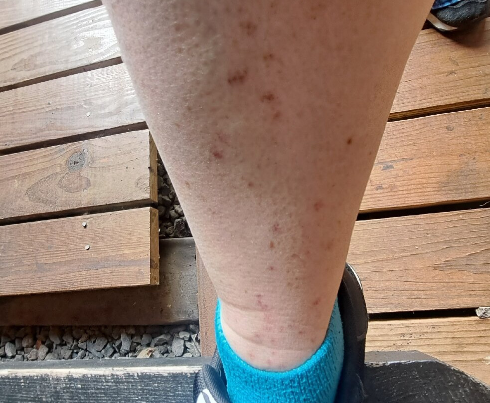 布拉德福德智选假日酒店主图