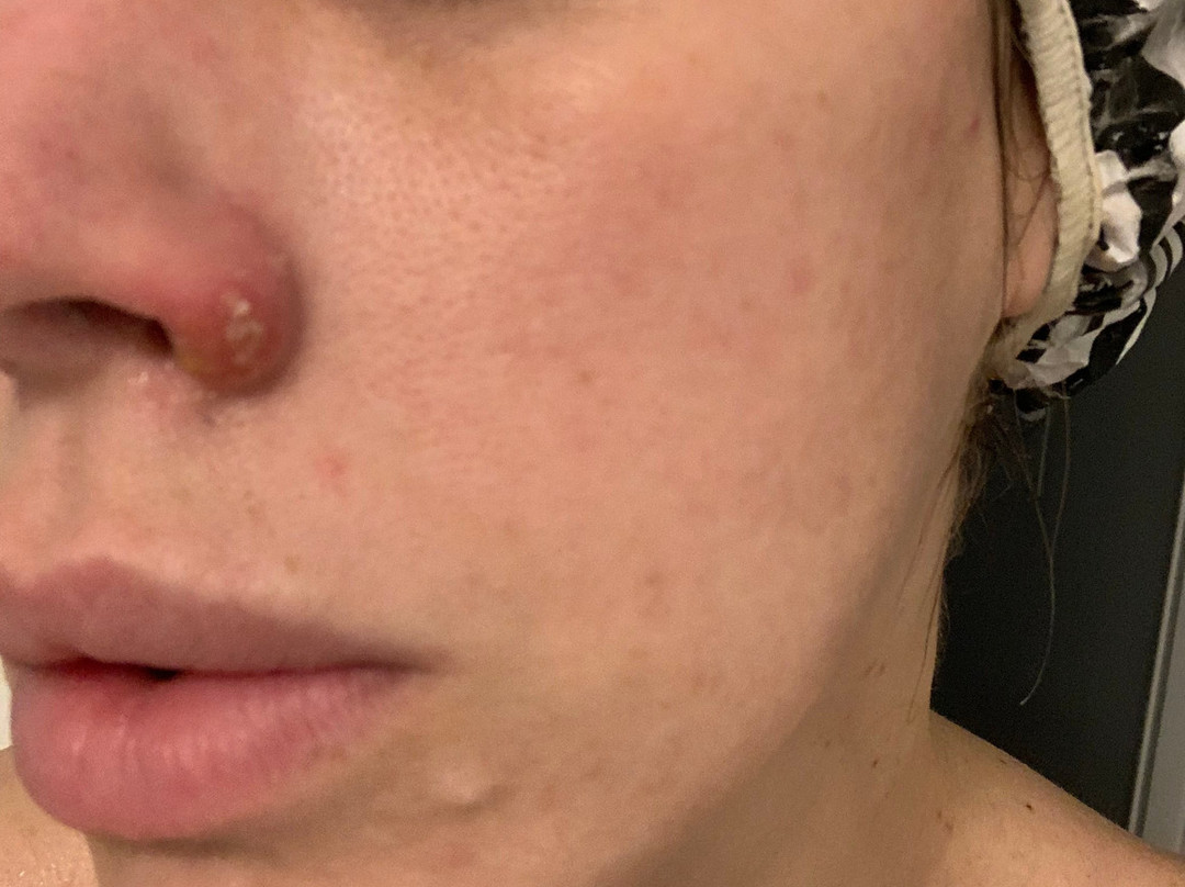 Simply Skin-汤姆斯河必去景点