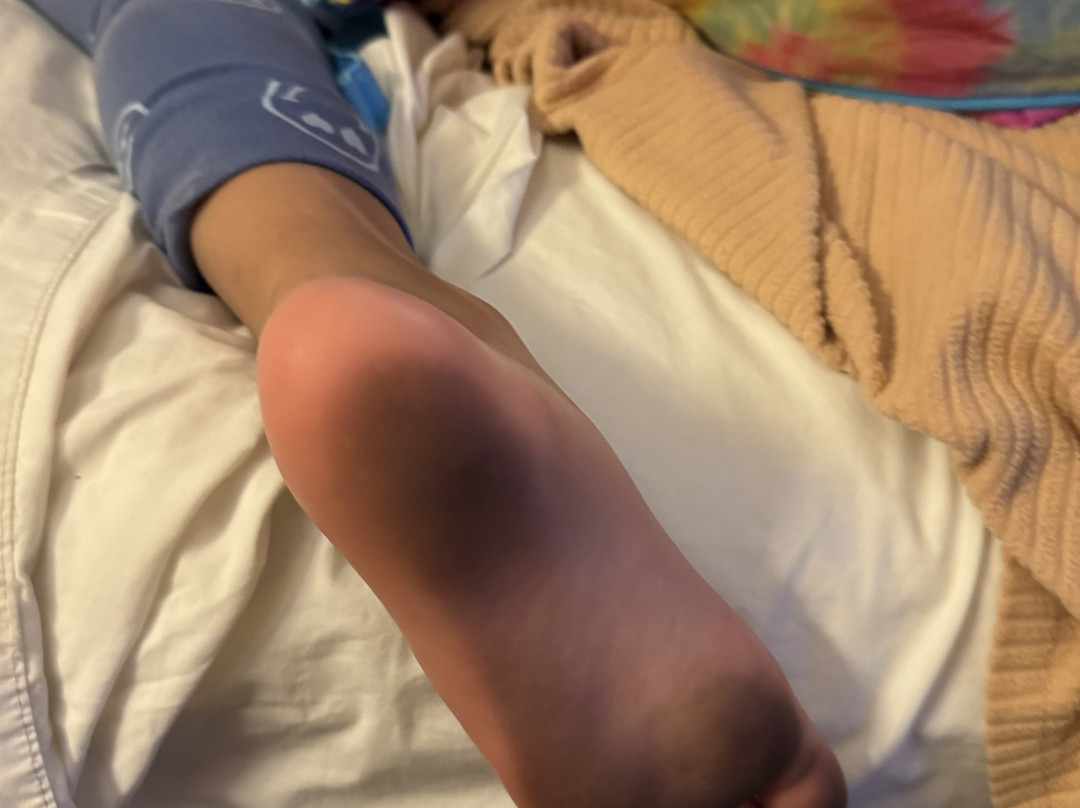 印第安纳波利斯格林伍德红顶酒店主图