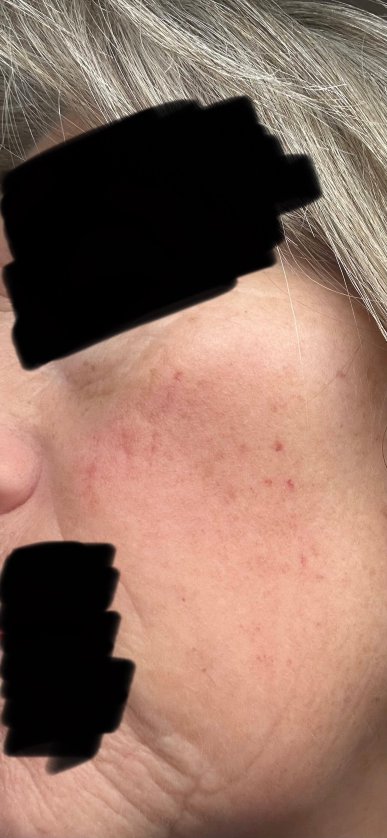 Hoar Cross Hall Hotel And Spa-官方