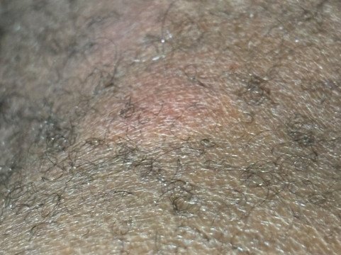 智选假日套房酒店阿比林主图