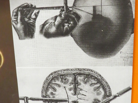 Glore Psychiatric Museum-圣约瑟夫必去景点