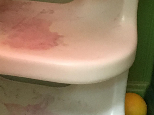 Round the Twist-Holt必去景点