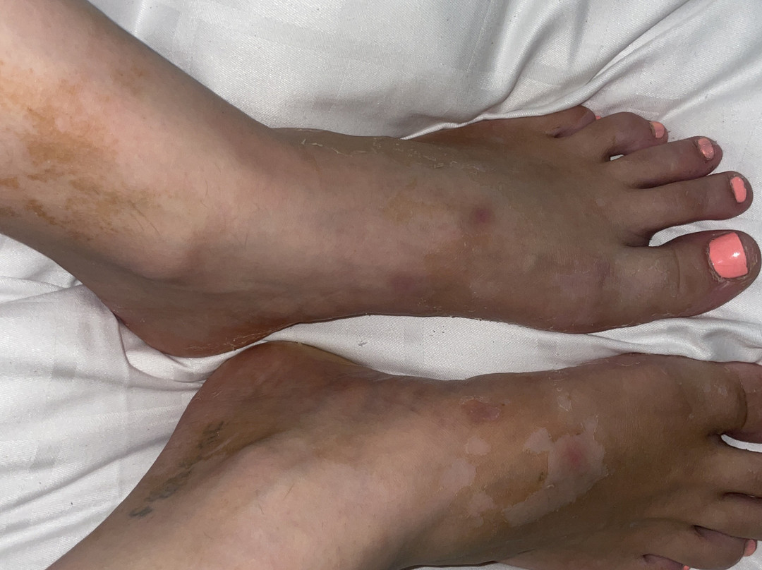 Lost City - Gustavsvik-厄勒布鲁必去景点