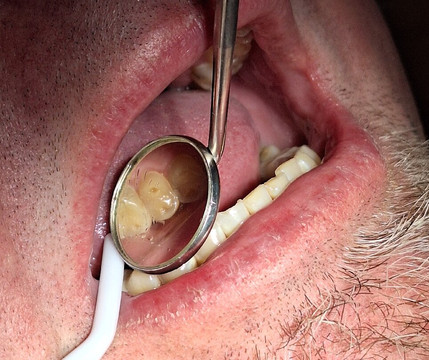 希尔顿欢朋套房酒店-菲尼克斯城格兰岱尔/韦斯特盖特主图