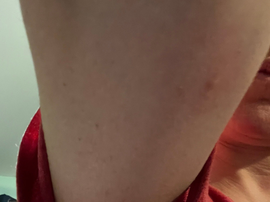 Candlewood Suites Boston North Shore - Danvers by IHG主图