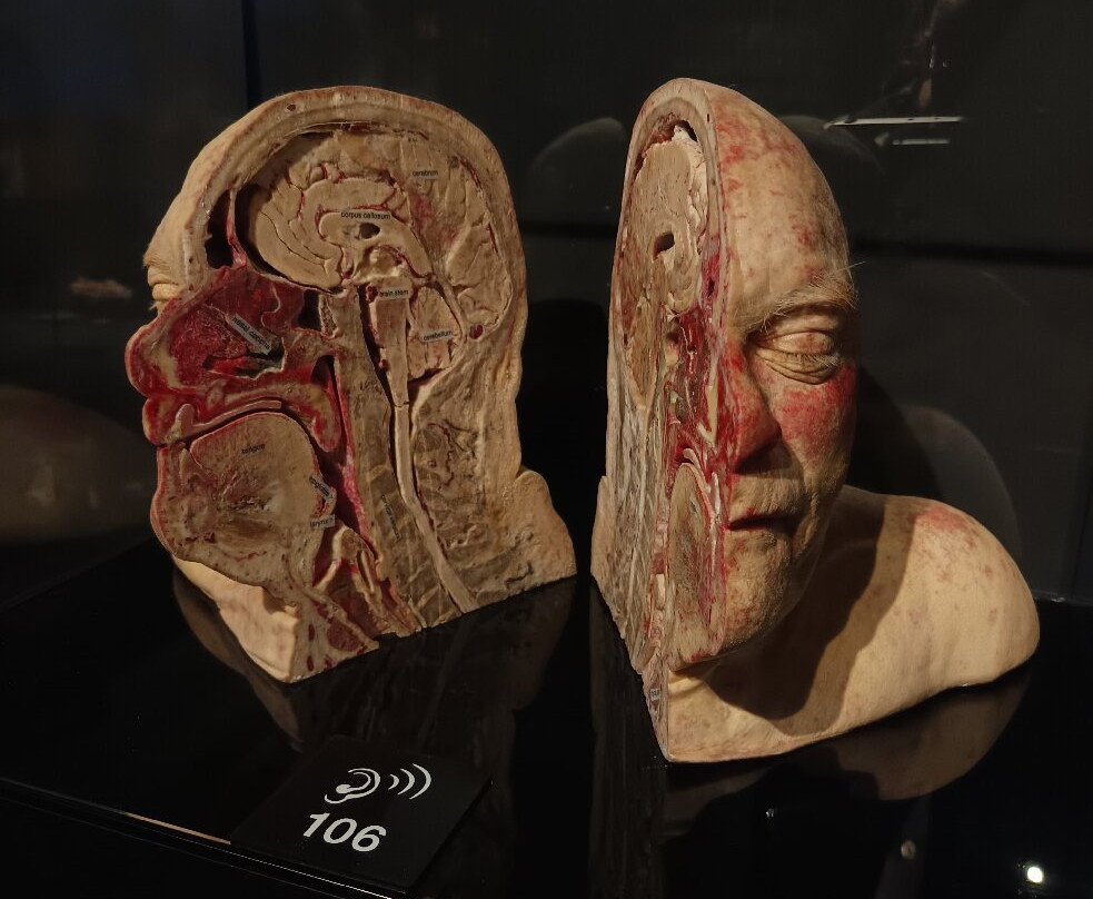 人体世界展览-阿姆斯特丹必去景点