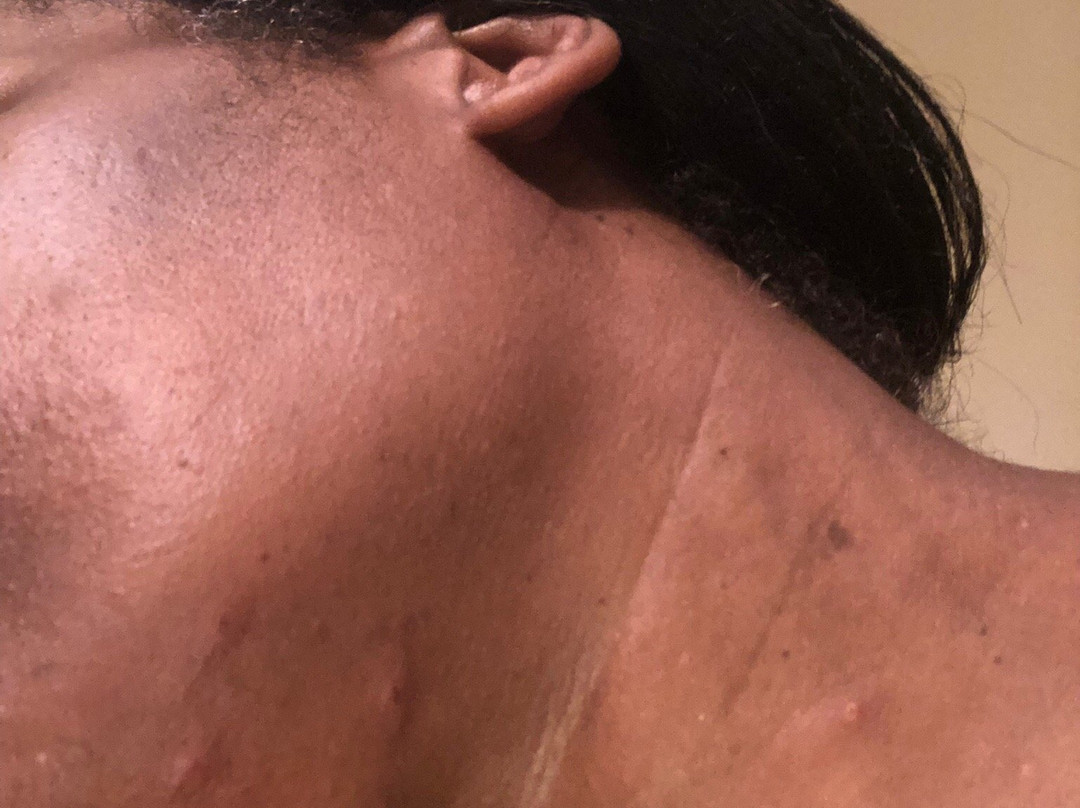 Drury Inn & Suites St. Louis O'Fallon, IL主图