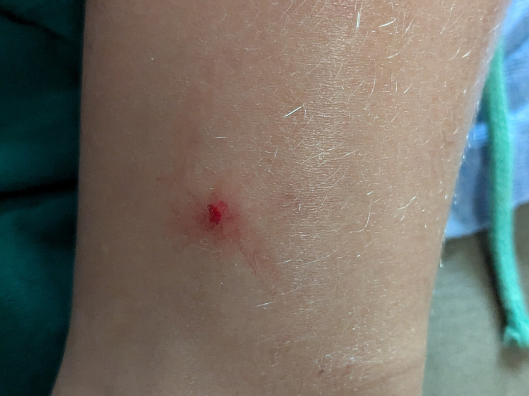 Cranes Mill Park-峡谷湖必去景点