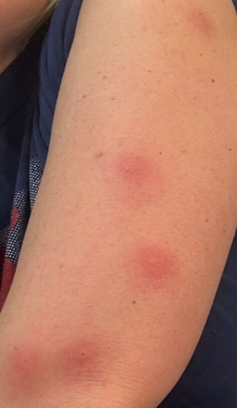 曼切斯特机场希尔顿惠庭套房酒店主图