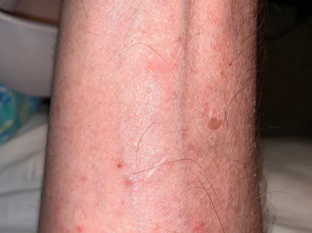 韦纳奇旅程住宿酒店主图