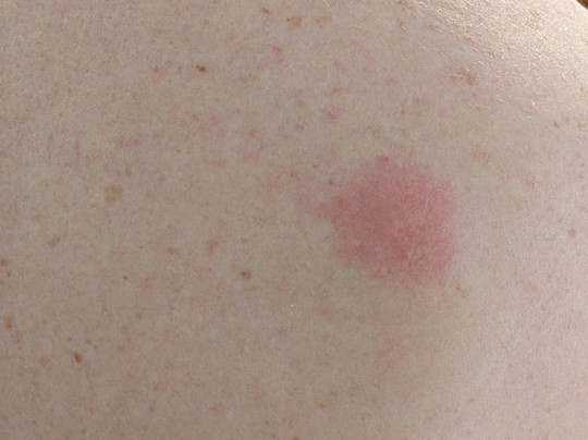 My Place Hotel-Fargo, ND主图