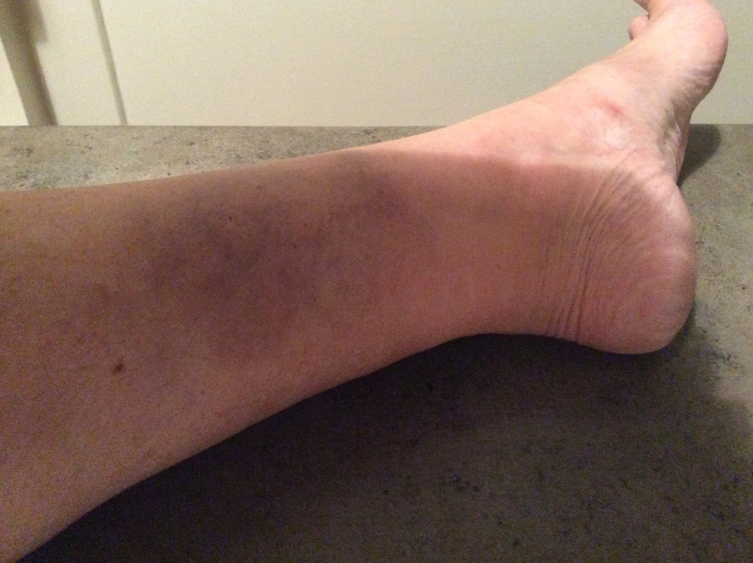 Butterfly World and the Boardwalk-蒙古顿必去景点