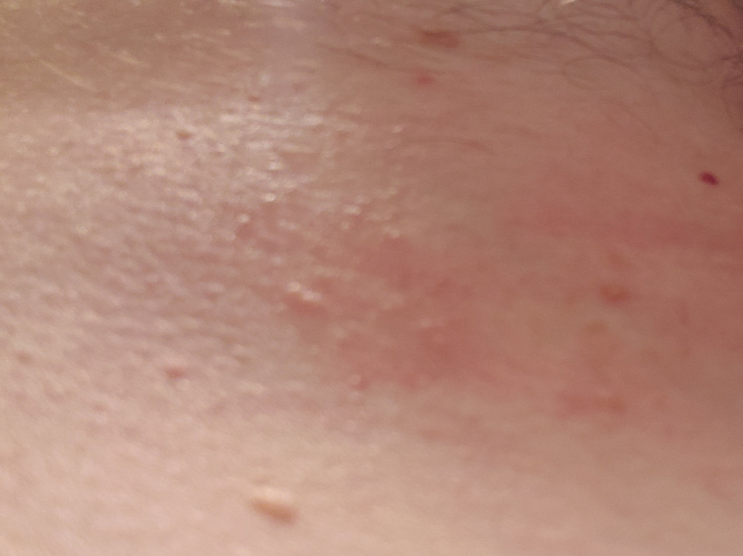 戴维斯拉金塔旅馆&套房酒店主图